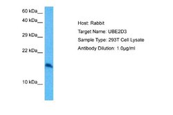 UbcH5c/UBE2D3 Rabbit anti-Human, Polyclonal, Novus Biologicals 0.1ml; Unconjugated:Antibodies,